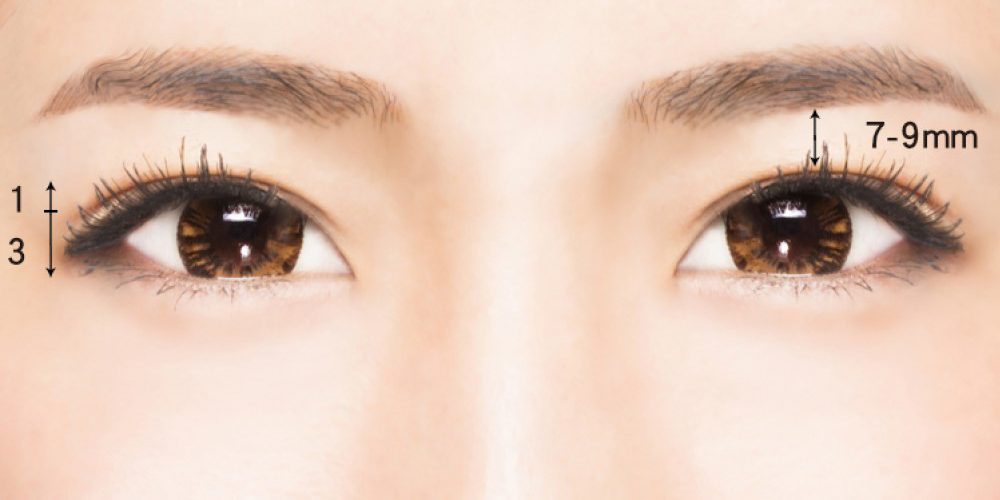 打造動人雙眼皮　黏貼還是手術好？