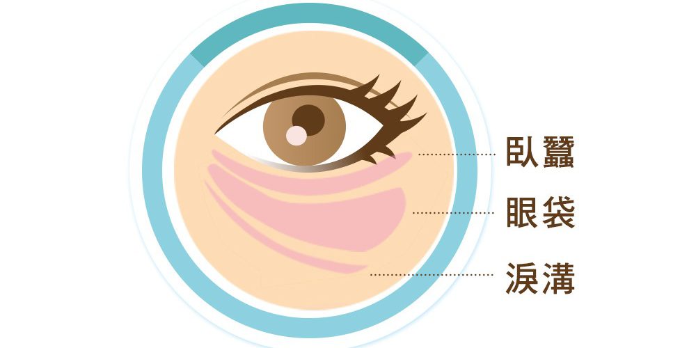 熬夜用眼過度 小心眼袋上身